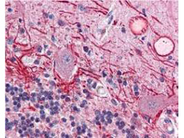 Immunohistochemistry of Mouse anti-AKT pT308 antibody. Tissue: human brain cerebellum tissue (40X). Fixation: formalin fixed paraffin embedded. Antigen retrieval: not required. Primary antibody: AKT pT308antibody at 20 µg/mL for 1 h at RT. Secondary antibody: Peroxidase rabbit secondary antibody at 1:10,000 for 45 min at RT. Localization: staining of Purkinje neurons and cell processes in the cerebellum, cytosolic as well as occasionally nuclear. Staining: AKT pT308 as precipitated red signal with hematoxylin purple nuclear counterstain.